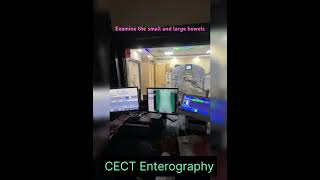 CT Scan Enterography [upl. by Dranreb]