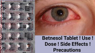 Betnesol Tablet  Betamethasone  Use  Dose  Side Effects  Precautions [upl. by Trauts]