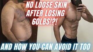 How to avoid loose skin after weight loss  Prevent excess skin after transformation [upl. by Eirelam]