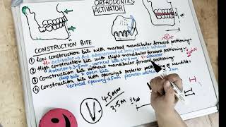 activator in orthodontics lecture I part 2 [upl. by Dermot118]