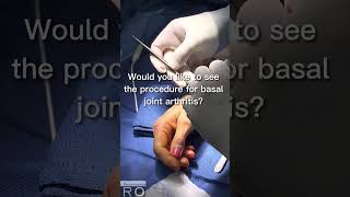 What procedure is needed for basal joint arthritis [upl. by Lamprey]