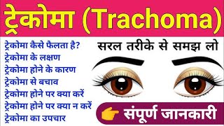 TRACHOMA BY DRPAWAN GUPTA [upl. by Dnumde]