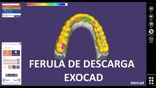 Ferula de descarga con exocad [upl. by Isis]