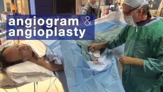 Angiogram amp angioplasty what to expect [upl. by Oibesue]