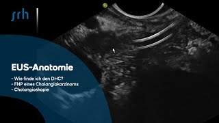 EUSAnatomie wie finde ich DHC Nachfolgend mit FNP eines Cholangiokarzinoms Cholangioskopie [upl. by Enimrac]