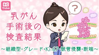 【病理後編】乳がん手術後の検査結果～組織型、グレード、Ki67、脈管侵襲、断端～ 《BC Tube：乳癌の専門家による情報発信グループ》 [upl. by Attoynek]