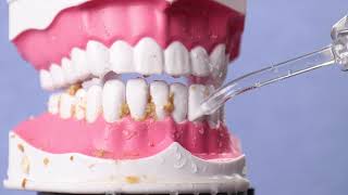 How to use a water flosser to clean teeth effectively [upl. by Gamaliel]