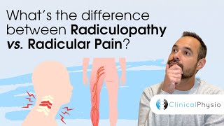 Whats the difference between Radiculopathy vs Radicular Pain  Expert Physio Guide [upl. by Riamo]