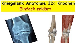 Kniegelenk Anatomie 3D Knochen [upl. by Yereffej]