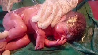 New born good weight baby removing a vernix clean with baby oil baby is so nice sund cry is good❣️ [upl. by Alta]