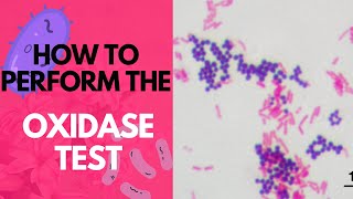 How to Perform the Oxidase TestMicrobiology [upl. by Maxi]