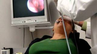 FinESS Sinus Treatment  Physician Instructional Video [upl. by Dianthe89]