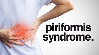 Everything You Need To Know About Piriformis Syndrome [upl. by Cissy27]