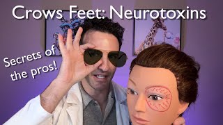 Neurotoxins  Crows Feet Perfected [upl. by Oneil821]