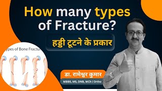 Common types of Bone fracture  Types of Fracture  How many types of Fracture fracture [upl. by Stephine]