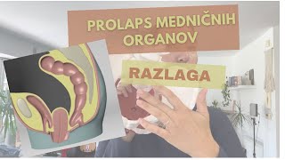 PROLAPS MEDENIČNIH ORGANOV [upl. by Winson]