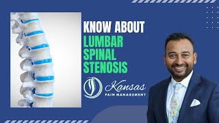 Are you suffering from back pain due to Lumbar Spinal Stenosis [upl. by Lanaj]