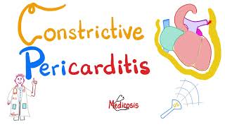 Constrictive Pericarditis  Causes Symptoms Signs Diagnosis amp Management  Cardiology [upl. by Adlemi]