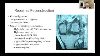 Posterolateral Corner Injuries  Diagnosis amp Management  Dr Brett Fritsch [upl. by Adnac]