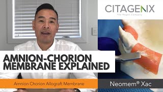 NEW AmnionChorion Membrane for Dental Oral Maxillofacial Surgeries  Citagenix [upl. by Cavit]