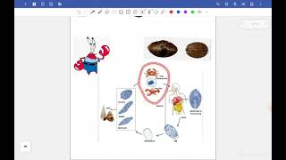 L1 Para Paragonimiasis and House dust mites Resp 42 [upl. by Navarro]