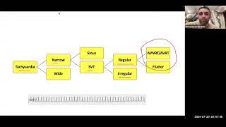 Arrhythmia lectures Tachyarrhythmias By prof Mohamed Ibrahim [upl. by Labaw]