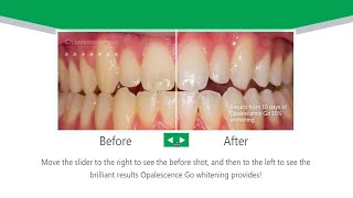 Opalescence Go  Take Home Teeth Whitening [upl. by Aitnahc]