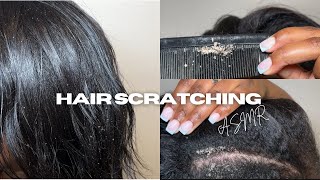 Scalp scratching ASMR Flakes Scalp psoriasis [upl. by Cthrine]