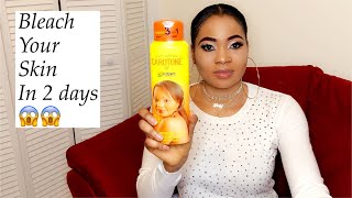 2 days skin bleaching cream stretch marks and dark knuckles my honest review [upl. by Eiramaliehs]