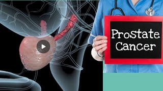 Prostate cancer ke lakshan  Prostate cancer signs in Hindi [upl. by Sac]