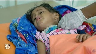 Diphtheria takes a deadly stranglehold on wartorn Yemen [upl. by Westerfield170]