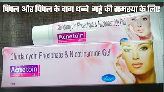 Acnetoin Gel review चेहरे के दाग़ धब्बे एक्ने पिम्पल्स को कैसे रोके acnetoin gel uses hindi acne [upl. by Annabelle265]