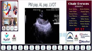 EPAC 24  S5  Utility of Intracardiac Echocardiography in EP Studies  Dr Shady Nakhla [upl. by Euqina418]