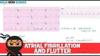 Rate and Rhythm  Atrial Fibrillation and Atrial Flutter [upl. by Ahsilaf]