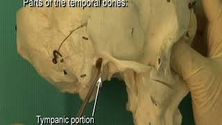 Petrous part of temporal bone [upl. by Oranneg]