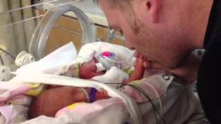 Preemie born at 27 weeks plays with her Daddy [upl. by Pantin]