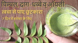 Pimple Daag Dhabbe व Oily Skin से पाए छुटकारा पाए हमेशा के लिए How To Remove Pimple Pimple Marks [upl. by Robertson]