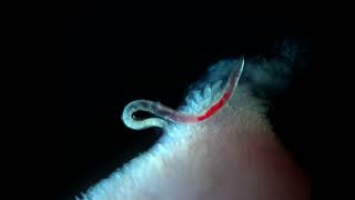 Bloodfeeding adult female Ancylostoma ceylanicum hookworm [upl. by Asin]