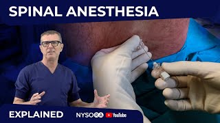 Spinal Anesthesia Explained Part 1 Crash course with Dr Hadzic [upl. by Burnard]