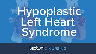 Hypoplastic Left Heart Syndrome HLHS  Pediatric Nursing [upl. by Ylreveb914]