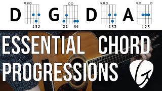 Chord Progression Practice  D G D A  These easy chords are a great place to start [upl. by Ethe]