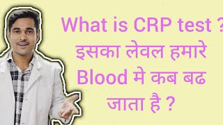 What Is CRP Test  CReactive Protein Test  Explained in Hindi  Critical Value Of CRP [upl. by Cameron]