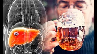 Anatomy and Physiology of Alcohol Effects Dangers  How Alcohol Effects [upl. by Haswell]