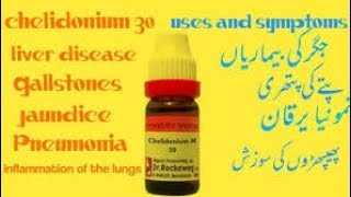 How to use Chelidonium Homeopathic Medicine For Healthy LiverDrkirtivikramsinghbyDr Adil Farooq [upl. by Ariaec]