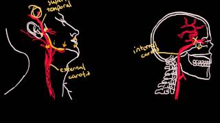 Temporal Arteritis [upl. by Sanburn]