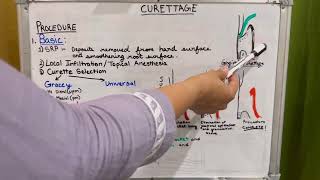 Curettage  Dental Notes 1 [upl. by Goldy]