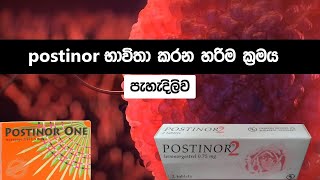 උපත් පාලනයට postinor භාවිතා කරන නිවැරදි ආකාරය 😨 How to use postinor 1 and 2 tablets sinhala [upl. by Schiffman274]