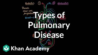 Types of pulmonary diseases  Respiratory system diseases  NCLEXRN  Khan Academy [upl. by Diahann]