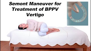 Semont Maneuver for BPPV Vertigo Treatment Alternative to Epley Maneuver [upl. by Niwdla]