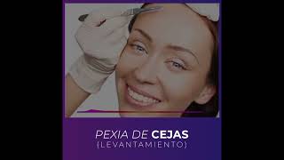 PEXIA DE CEJAS Levantamiento [upl. by Fawcette]